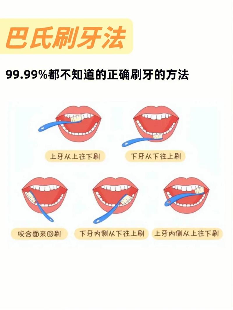 正确的刷牙方法「45度倾斜刷牙」 减肥知识