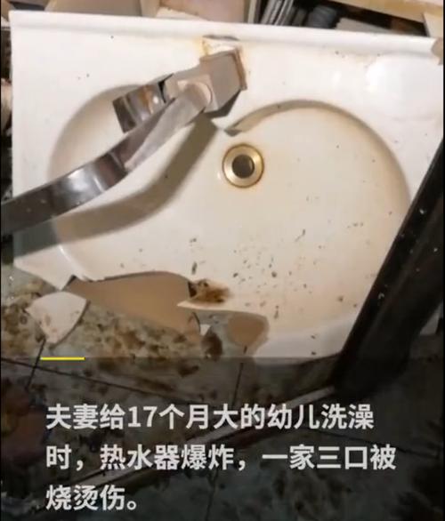 热水器爆炸，沈阳一家三口特重度烧伤，厂家捐款5万，怎么回事「烧伤妈妈情况不好怎么办」 减肥视频